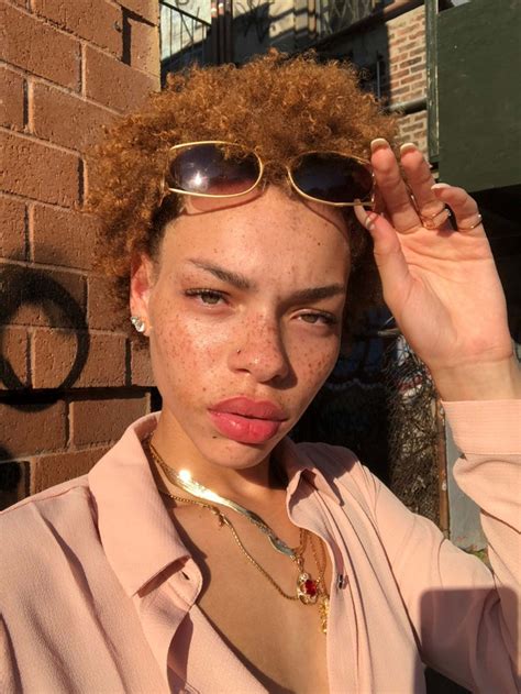 These 5 Models Are Revolutionizing The Freckle Movement Across All Skin