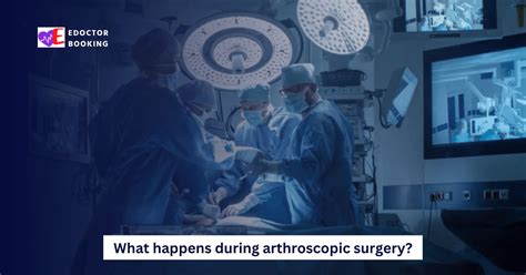 Arthroscopic Surgery Definition Benefits Risks