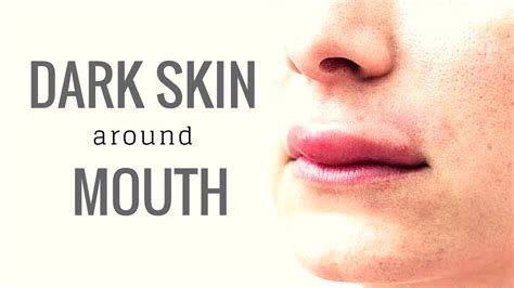 How To Get Rid Of Dark Skin Around Mouth Remove Dark Patches Around