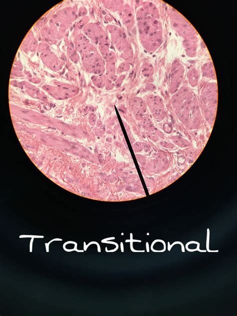 Transitional Epithelium Human Anatomy And Physiology Anatomy And