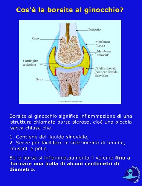 Borsite Al Ginocchio I Sintomi E La Fisioterapia