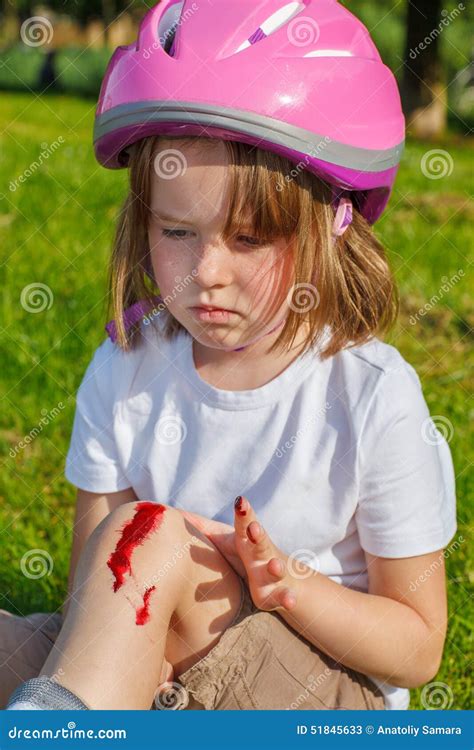 Unhappy Girl With Her Knee Bleeding Stock Image Image Of Pink