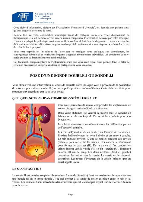 Faire L Amour Avec Une Sonde Jj - montee jj par Claude BORGOGNO - Fichier PDF