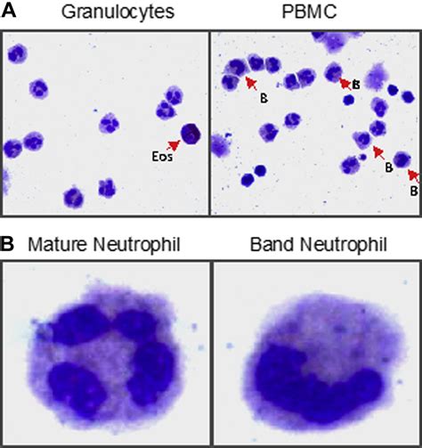 Immature Granulocytes Normal Range