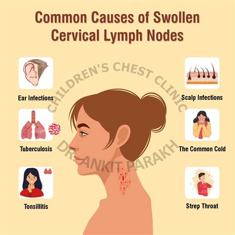 What Causes Mandibular Lymph Nodes To Swell Types Of