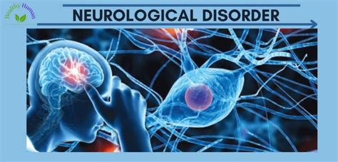 Rare Neurological Disorders In Humans