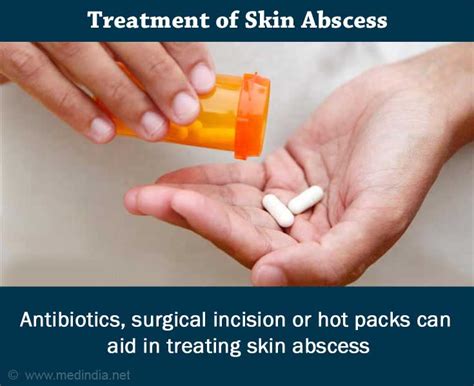 Boils Skin Abscess Causes Symptoms Diagnosis Treatment