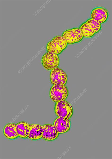 Streptococcus Pyogenes Tem Stock Image C0129964 Science Photo