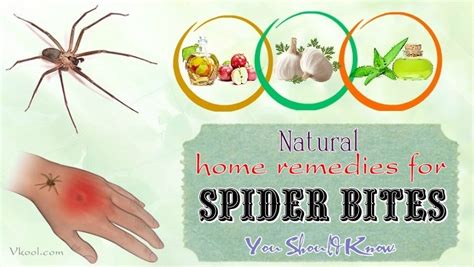 16 Natural Home Remedies For Spider Bites You Should Know