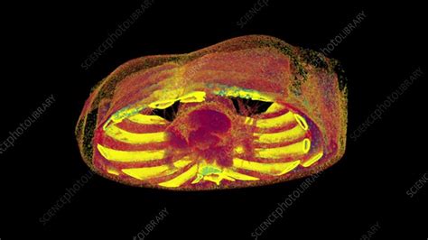 Chest Section 3d Ct Scan Stock Video Clip K0103686 Science