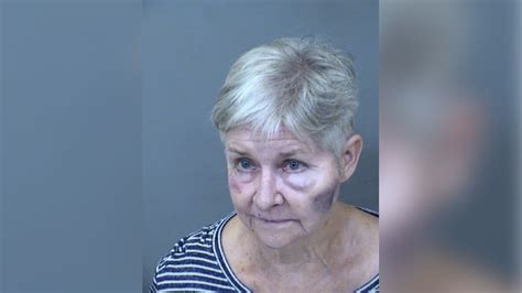 Police 71 Year Old Woman Accused Of Beating Husband Was ‘tired Of Taking Care Of Him’