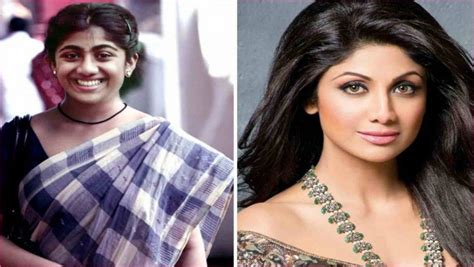 Bollywood Celebrity Plastic Surgery Before And After Celebrity