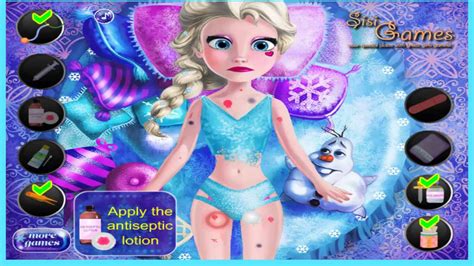 Frozen En EspaÑol Juegos Curando A Elsa Frozen Games Youtube