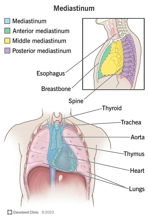 Tumori Mediastinici Cause Sintomi Diagnosi E Trattamenti Aranjuez