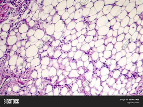Adipose Tissue Heart Image And Photo Free Trial Bigstock