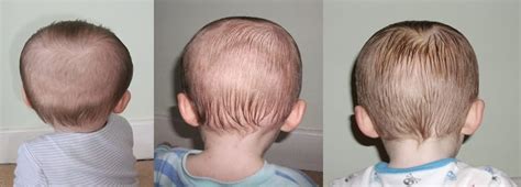 Karens Baby Blog Photos Before And After