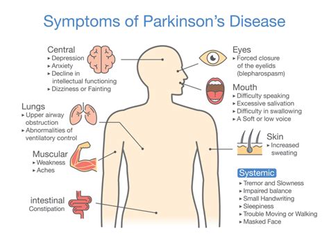 Parkinsons Disease Stages Dementia Minimalistisches Interieur