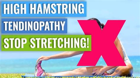 High Hamstring Tendinopathy Dont Stretch It Hamstrings Therapy
