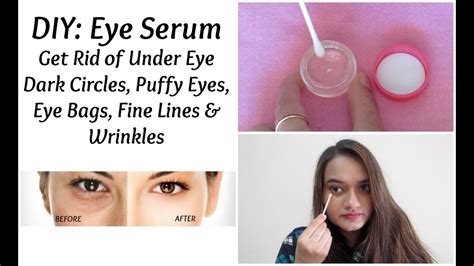 How To Remove Dark Circles Fine Line And Wrinkles Naturally At Home Diy Eye Serum Youtube