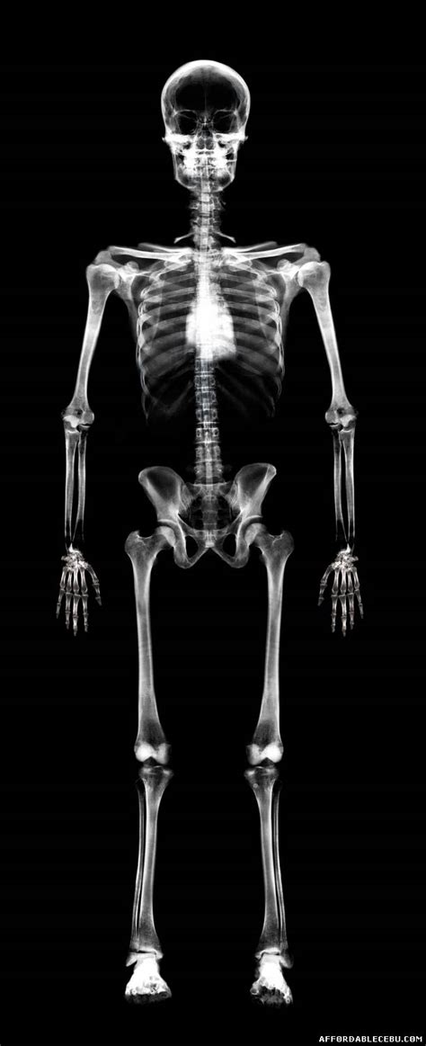 Smart guides, which appear automatically when you need them, help you line up your shapes, slices, and selections. Incredible Human X-Ray Pictures - Photoshop / Graphics 626