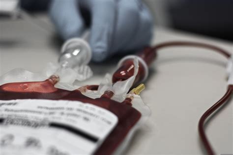 You must be at least 17 years old to donate to the general blood supply, or 16 years old with. 12 reasons you may not be able to donate blood | Review