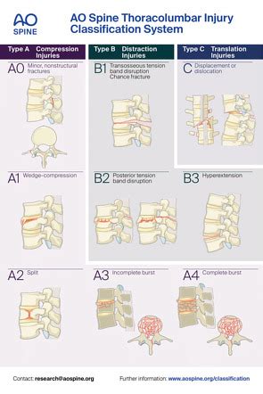 Ao Spine Classification Of Thoracolumbar Injuries Radiology Reference My XXX Hot Girl