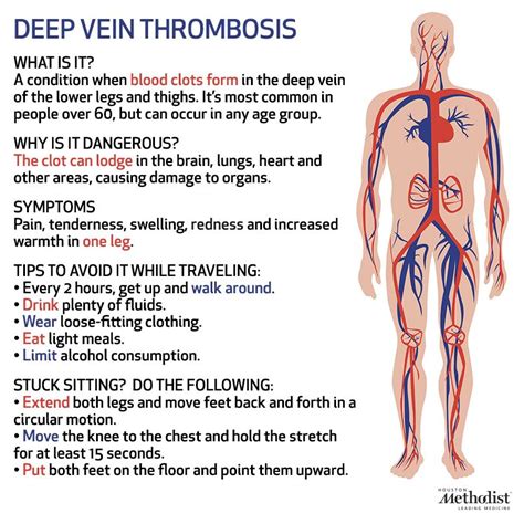 What Is Deep Vein Thrombosis What Are Its Symptoms Ambulatory Care