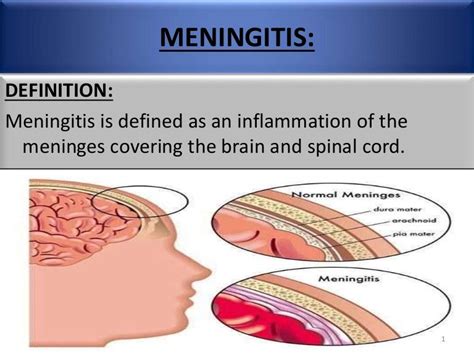Meningitis Disease