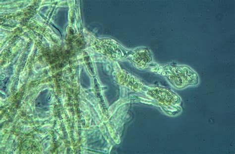 Cyanobacteria Large Images