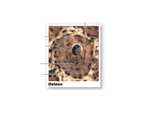 Home » anatomy bone labeling » anatomy bone labeling 603 most of the times, we put the labels to show some specific information. Osteon Bone Labeling Quiz