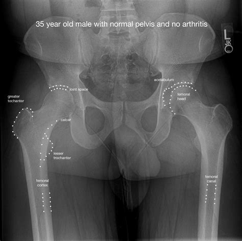 Normal Male Pelvis Annotated