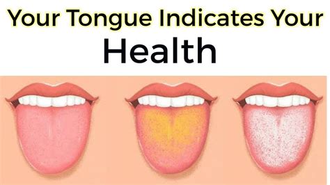 What Your Tongue Says About Your Health Youtube