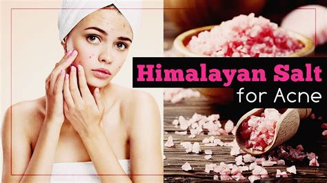 Himalayan Salt For Acne Benefits And Recipes Youtube