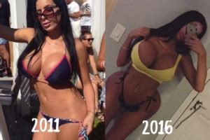 Photos Ig Model Kristyna Martelli Gets Surgeries To Fuel Hobby