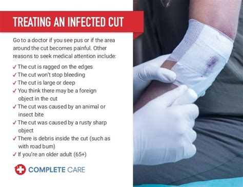 How To Tell If A Cut Is Infected