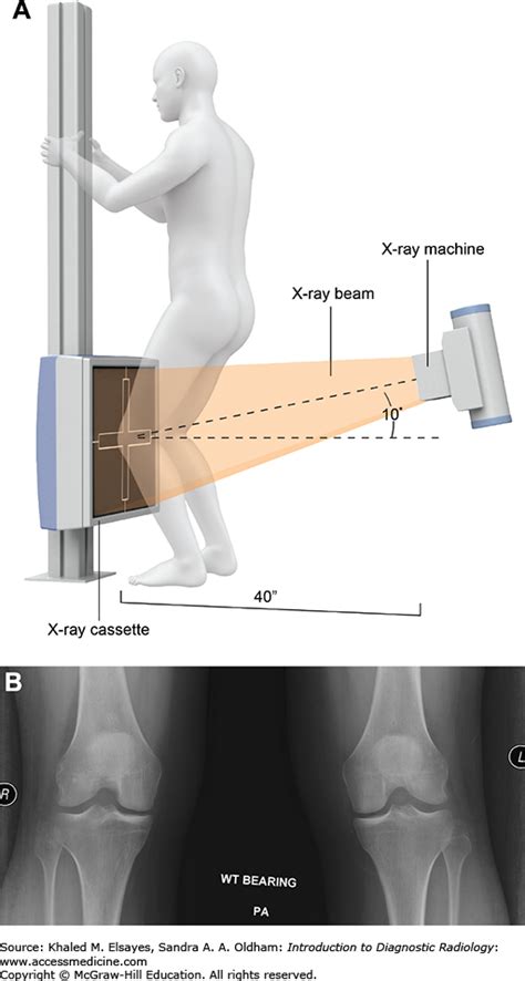 Musculoskeletal Radiology Key