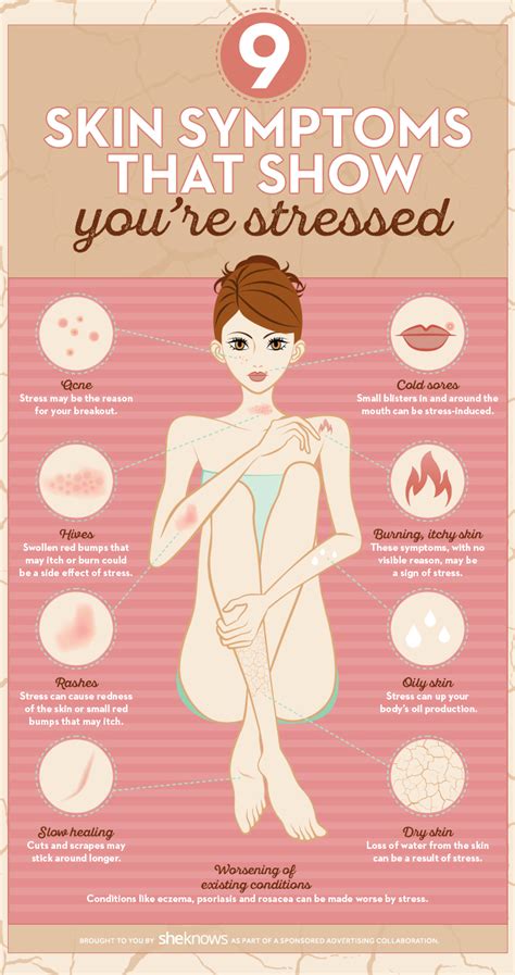 9 Skin Symptoms That Show Youre Stressed Sheknows