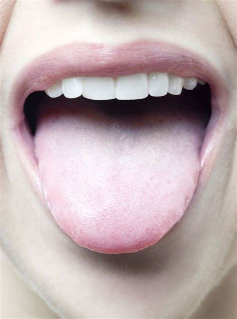 Diabetes Type 2 The Four Peculiar Mouth Symptoms Warning Of High Blood