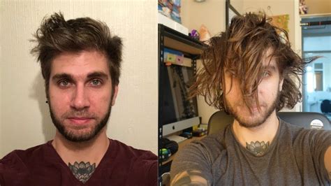 10 Month Hair Growth Timelapse 1 Pic A Day Youtube