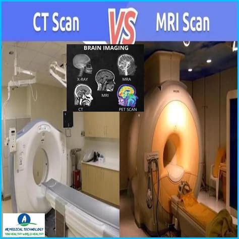 Ct Scan Vs Mri Whats The Difference Best Benefits And Risks 23