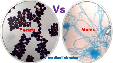 Yeasts And Molds Introduction Differences And Yeasts And Mold
