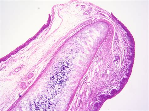 Histology Of Epiglottis Human Tissue Stock Image Image Of View Show