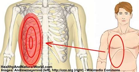 If your pancreas is inflamed, you'll often have intense pain that begins behind your rib cage and spreads to the right side of your chest. Pin on Spinal Stenosis..&..Arthritis