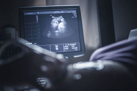 Fetal Echocardiogram Procedure Risks And Results