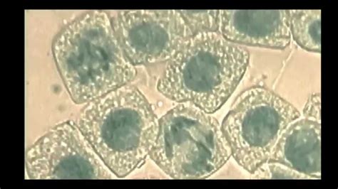 Mitosis Phases Under Microscope Labeled