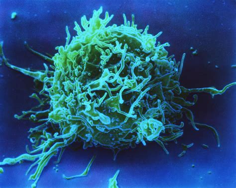 Coloured Sem Of A T Lymphocyte White Blood Cell Photograph By Nibsc