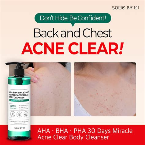As the body attempts to. Some By Mi - AHA.BHA.PHA 30 Days Miracle Acne Clear Body ...
