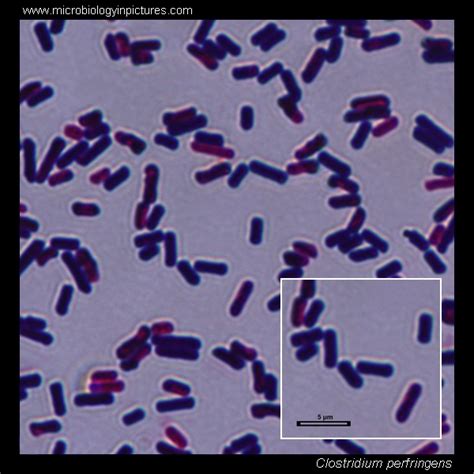 Clostridium Perfringens Gram Stain And Cell Morphology Clostridium