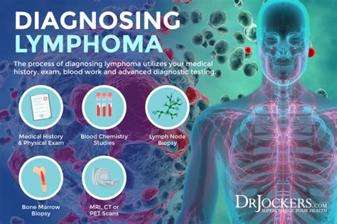 Lymphoma Symptoms Causes And Support Strategies