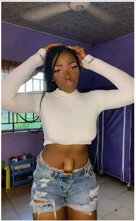 Woman With Protruding Belly Button Goes Viral As She Proudly Shows It